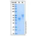 Recombinant Human Coagulation Factor Xa Protein