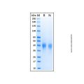 Recombinant Human KIR2DL3/CD158b2 Protein
