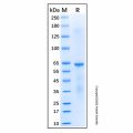 Recombinant Human Chk2 Protein
