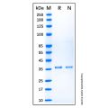 Recombinant Human Cytokeratin 5 Protein