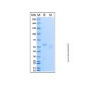 Recombinant Human ATM Protein
