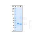 Recombinant Human ATR Protein