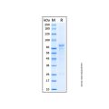Recombinant Human Sirtuin 1/SIRT1 Protein