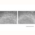Recombinant Human NCAM-1/CD56 Protein