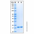Recombinant Human Topoisomerase II alpha/TOP2A Protein