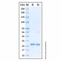 Recombinant Human Cytokeratin 9 Protein