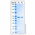 Recombinant Human Catalase Protein