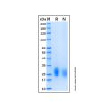 Recombinant Human GIPR Protein