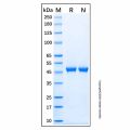 Recombinant Human SHP-1 Protein