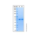 Recombinant Human ENO3 Protein
