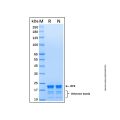 Recombinant Human RP9 Protein