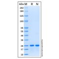 Recombinant Human CBX1/HP1 beta Protein