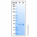 Recombinant Human IL36 beta/IL-1F8 Protein