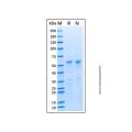 Recombinant Human FTO Protein