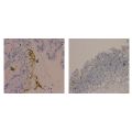 Recombinant Helicobacter pylori Antibody