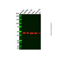 Recombinant ACAA2 Antibody