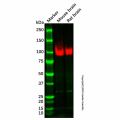 Recombinant Amyloid Precursor Protein Antibody