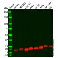 Recombinant eIF4EBP1 Antibody