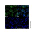 Recombinant EpCAM Antibody
