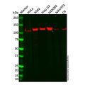 Recombinant GART Antibody