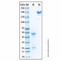 Mouse Anti-Human IgM Antibody