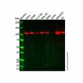 Recombinant Insulin degrading enzyme/IDE Antibody