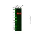 Recombinant PARP1 Antibody
