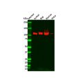 Recombinant PYK2 Antibody
