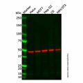 Recombinant YB1 Antibody