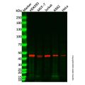 TBP Mouse mAb