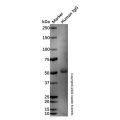 Goat Anti-Human IgG Fc (Alkaline Phosphatase)