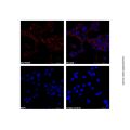 alpha-Smooth Muscle Actin Mouse mAb (Cy5)