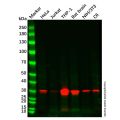 Recombinant ARPC2 Antibody