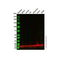 Recombinant RPS19 Antibody