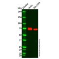 Carcino Embryonic Antigen CEA Antibody