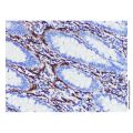 NCAM1 Mouse mAb