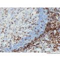Recombinant CD4 Antibody
