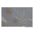 Recombinant CD10 Antibody