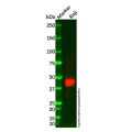 CD23 Mouse mAb