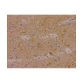 Recombinant Neurofilament-M Antibody