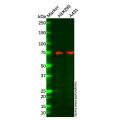ABCD2 Antibody