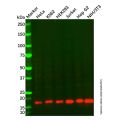 Acid phosphatase/ACP1 Mouse mAb