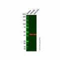 Recombinant ACTC1/ACTA2/ACTG2 Antibody