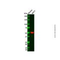 ADAT1 Antibody