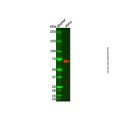 Adducin 2 Antibody