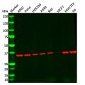 Recombinant Adenosine A1 Receptor Antibody
