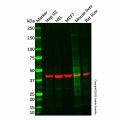 Adiponectin Receptor 2/ADIPOR2 Antibody