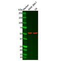 Recombinant Adipose Triglyceride Lipase Antibody