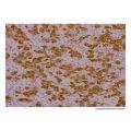 Recombinant ALK Antibody