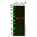 Recombinant ALK-1 Antibody